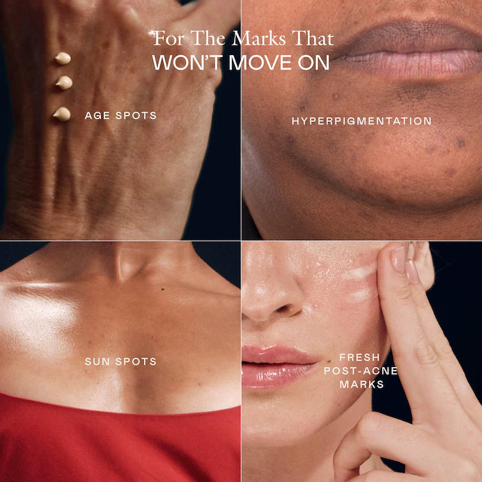 EADEM The Mark Advanced Targeted Dark Spot Concentrate with 5% Tranexamic Acid, 1% Alpha Arbutin & 1% Kojic Acid for Hyperpigmentation, Acne Marks & Age Spots