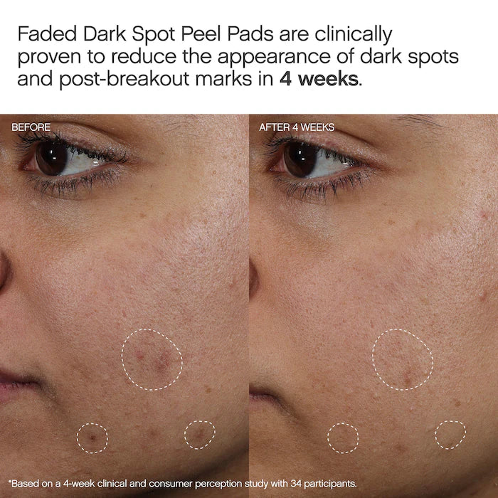 Topicals Faded Brightening Peel Pads for Dark Spots, Discoloration & Uneven Skin Tone (12 pack)