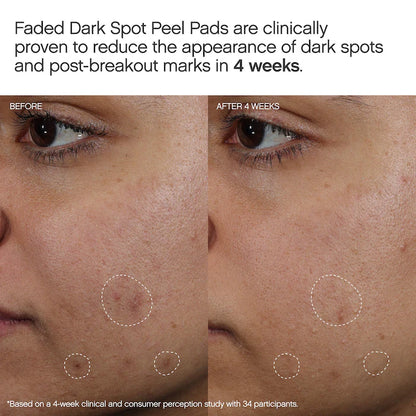 Topicals Faded Brightening Peel Pads for Dark Spots, Discoloration & Uneven Skin Tone (12 pack)