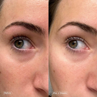 Topicals Faded Under Eye Brightening & Clearing Eye Masks