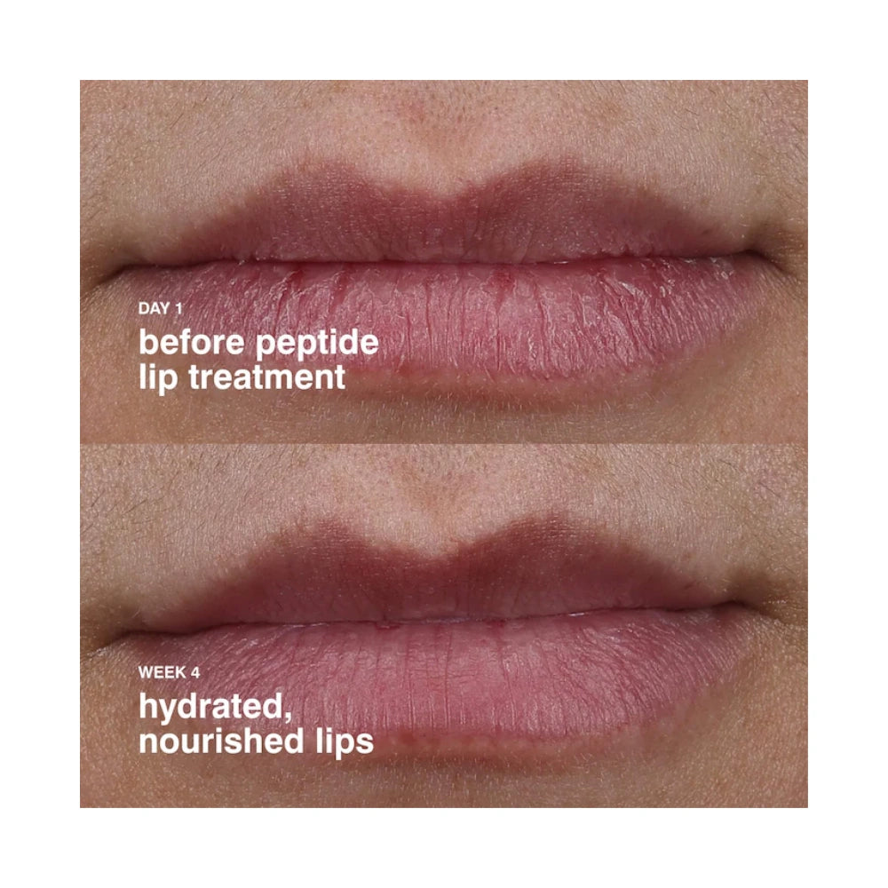 Rhode Peptide Lip Treatment Nourishing Glaze - 10ml Watermelon Slice