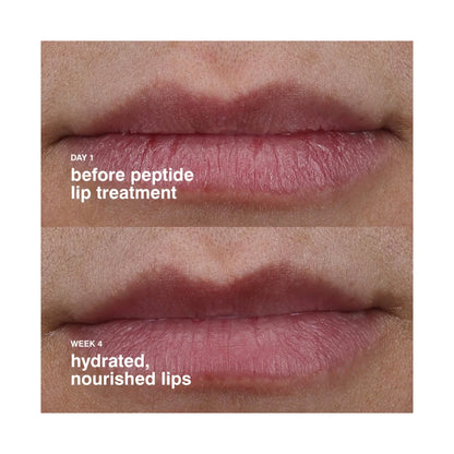 Rhode Peptide Lip Treatment Nourishing Glaze - 10ml Watermelon Slice