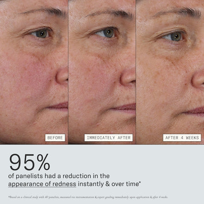 Dieux Deliverance 3-in-1 Repair Serum for Redness, Wrinkles, Dark Spots